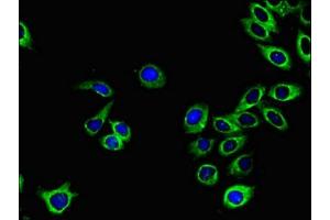 Immunofluorescence (IF) image for anti-Ephrin Type A Receptor 1 (EPHA1) (AA 296-414) antibody (ABIN7151827)