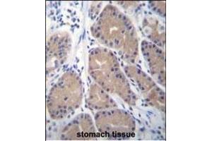 CA1 Antibody (N-term) (ABIN656574 and ABIN2845835) immunohistochemistry analysis in formalin fixed and paraffin embedded human stomach tissue followed by peroxidase conjugation of the secondary antibody and DAB staining. (CA1 antibody  (N-Term))