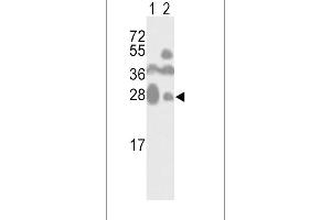 Western blot analysis of CD81 Antibody (C-term) (ABIN390568 and ABIN2840897) in mouse kidney(lane 1) and cerebellum(lane 2) tissue lysates (35 μg/lane).