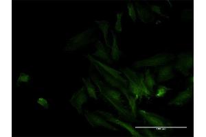 Immunofluorescence of monoclonal antibody to ODF2 on HeLa cell. (ODF2 antibody  (AA 706-804))