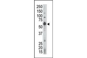 Western Blotting (WB) image for anti-Lymphocyte-Specific Protein tyrosine Kinase (LCK) (N-Term) antibody (ABIN359986) (LCK antibody  (N-Term))