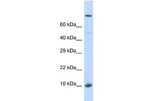 Western Blotting (WB) image for anti-NOP2/Sun Domain Family, Member 5 Pseudogene 1 (NSUN5P1) (N-Term) antibody (ABIN2785123)