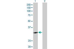 Western Blot analysis of ZNF124 expression in transfected 293T cell line by ZNF124 MaxPab polyclonal antibody. (ZNF124 antibody  (AA 1-289))