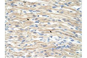 EXOSC6 antibody was used for immunohistochemistry at a concentration of 4-8 ug/ml to stain Skeletal muscle cells (arrows) in Human Muscle.