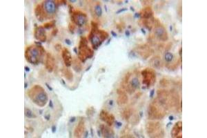 #VALUE! (FGL1 antibody  (AA 23-314))