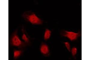 ABIN6275314 staining A549 by IF/ICC. (NUMA1 antibody  (N-Term))