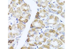 Immunohistochemistry of paraffin-embedded Human stomach using PIK3CA Polyclonal Antibody at dilution of 1:100 (40x lens). (PIK3CA antibody)