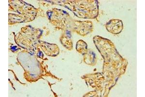 Immunohistochemistry of paraffin-embedded human placenta tissue using ABIN7170995 at dilution of 1:100 (SOCS2 antibody  (AA 1-198))