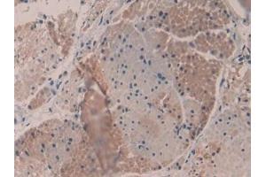 Detection of MYH16 in Human Esophagus Tissue using Polyclonal Antibody to Myosin Heavy Chain 16 (MYH16) (MYH16 antibody  (AA 209-469))