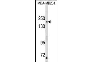 Western blot analysis of TBC1D4 Antibody (N-term) (ABIN652462 and ABIN2842314) in MDA-M cell line lysates (35 μg/lane). (TBC1D4 antibody  (N-Term))