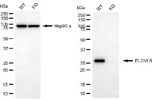 anti-ELOVL Fatty Acid Elongase 5 (ELOVL5) antibody