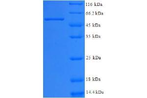 SDS-PAGE (SDS) image for WD Repeat Domain 5 (WDR5) (AA 2-334) protein (His-SUMO Tag) (ABIN4975988) (WDR5 Protein (AA 2-334) (His-SUMO Tag))