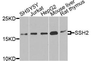 Western blot analysis of extracts of various cells, using SSH2 antibody. (SSH2 antibody)