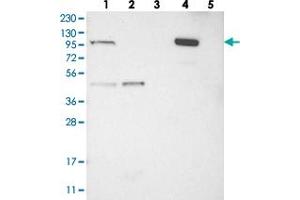 Western blot analysis of Lane 1: RT-4, Lane 2: U-251 MG, Lane 3: Human Plasma, Lane 4: Liver, Lane 5: Tonsil with C1orf112 polyclonal antibody . (C1orf112 antibody)