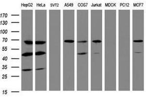 Image no. 3 for anti-IlvB (Bacterial Acetolactate Synthase)-Like (ILVBL) antibody (ABIN1498882)