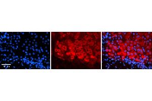 Rabbit Anti-CSF1 Antibody    Formalin Fixed Paraffin Embedded Tissue: Human Adult liver  Observed Staining: Cytoplasmic Primary Antibody Concentration: 1:600 Secondary Antibody: Donkey anti-Rabbit-Cy2/3 Secondary Antibody Concentration: 1:200 Magnification: 20X Exposure Time: 0. (M-CSF/CSF1 antibody  (N-Term))