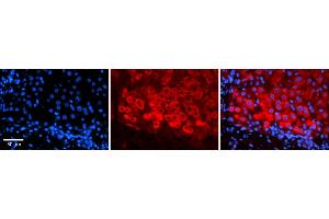 Rabbit Anti-CSF1 Antibody    Formalin Fixed Paraffin Embedded Tissue: Human Adult liver  Observed Staining: Cytoplasmic Primary Antibody Concentration: 1:600 Secondary Antibody: Donkey anti-Rabbit-Cy2/3 Secondary Antibody Concentration: 1:200 Magnification: 20X Exposure Time: 0.