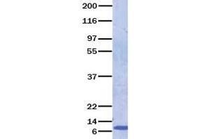 Validation with Western Blot (CCL8 Protein)