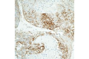 Immunohistochemistry (IHC) image for anti-Claudin 1 (CLDN1) (C-Term) antibody (ABIN7453966) (Recombinant Claudin 1 antibody  (C-Term))