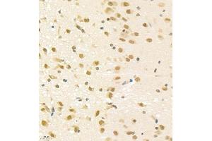 Immunohistochemistry of paraffin embedded rat brain using PGBD5 (ABIN7075082) at dilution of 1:2000 (400x lens) (PGBD5 antibody)