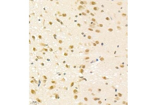 PGBD5 antibody