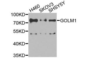 Western blot analysis of extracts of various cell lines, using GOLM1 antibody.