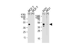 Western blot analysis of lysate from MCF-7, A431 cell line, using CALCR Antibody (C-term) (ABIN651875 and ABIN2840433) with(+) or without(-) peptides. (Calcitonin Receptor antibody  (AA 465-494))