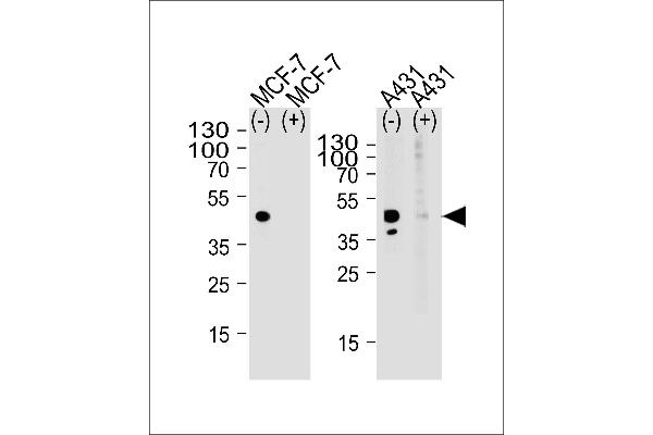 Calcitonin Receptor antibody  (AA 465-494)