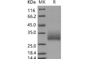 Western Blotting (WB) image for Killer Cell Lectin-Like Receptor Subfamily B Member 1A (Klrb1a) protein (His tag) (ABIN7320141) (Klrb1a Protein (His tag))