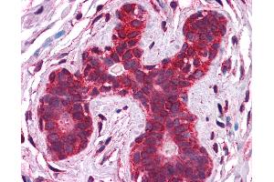 Anti-Calreticulin antibody IHC of human breast. (Calreticulin antibody  (AA 342-391))