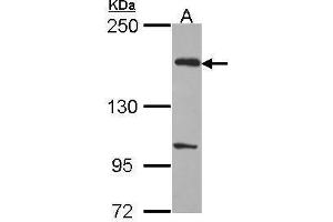 WB Image Sample (30 ug of whole cell lysate) A: H1299 5% SDS PAGE EVC2 antibody antibody diluted at 1:1000 (EVC2 antibody  (C-Term))