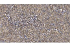 IHC analysis of Alpha B Crystallin/CRYAB using anti-Alpha B Crystallin/CRYAB antibody (ABIN7601209). (CRYAB antibody  (AA 30-151))