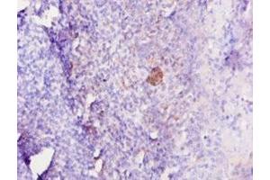 Immunohistochemistry of paraffin-embedded human tonsil tissue using ABIN7179323 at dilution of 1:10 (IL12B antibody  (AA 23-327))