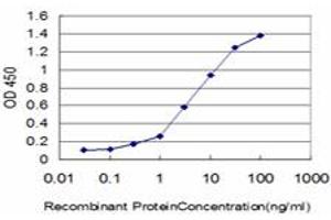 Detection limit for recombinant GST tagged KIAA2002 is approximately 0. (PEAK1 antibody  (AA 1151-1250))