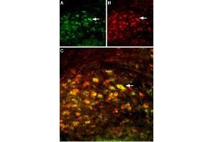 Multiplex staining of GluN2A and GluN2B in mouse deep cerebellar nucleus - Immunohistochemical staining of perfusion-fixed frozen mouse brain sections using Anti-NMDAR2B (GluN2B) (extracellular)-ATTO Fluor-594 Antibody (ABIN7043231), (1:60) and Anti-NMDAR2A (GluN2A) (extracellular) Antibody (ABIN7043228, ABIN7044324 and ABIN7044325), (1:200). (NMDAR2A antibody  (Extracellular))