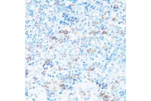 Immunohistochemistry (Paraffin-embedded Sections) (IHC (p)) image for anti-Fibroblast Growth Factor Receptor 2 (FGFR2) (AA 1-100) antibody (ABIN3022855)