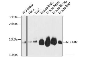 Western blot analysis of extracts of various cell lines using NDUFB2 Polyclonal Antibody at dilution of 1:3000. (NDUFB2 antibody)