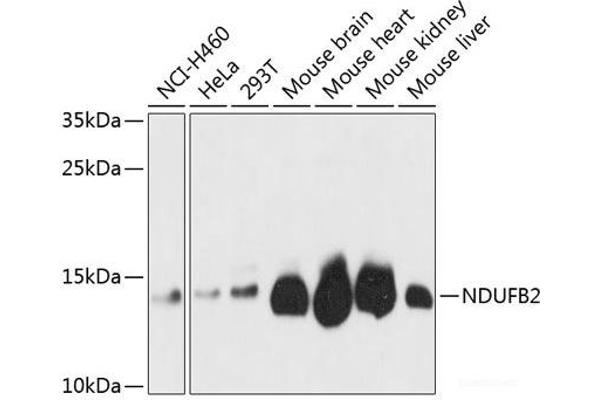 NDUFB2 抗体