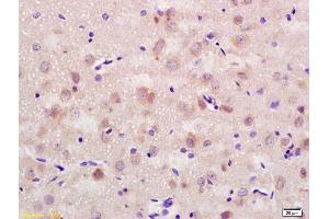 Formalin-fixed and paraffin embedded rat brain labeled with Rabbit Anti CD56/NCAM1 Polyclonal Antibody, Unconjugated (ABIN728398) at 1:200 followed by conjugation to the secondary antibody and DAB staining (CD56 antibody  (AA 621-720))
