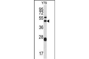 Western blot analysis of ARPC1A antibody in Y79 cell line lysates (35ug/lane) (ARPC1A antibody  (AA 157-184))