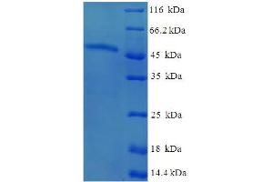 SDS-PAGE (SDS) image for AKT Interacting Protein (AKTIP) (AA 1-292), (full length) protein (His-SUMO Tag) (ABIN5711761) (AKTIP Protein (AA 1-292, full length) (His-SUMO Tag))