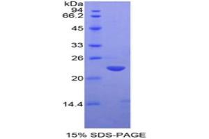 SDS-PAGE (SDS) image for Matrix Metallopeptidase 13 (Collagenase 3) (MMP13) (AA 286-462) protein (His tag) (ABIN2121610)