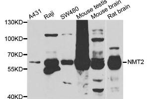 Western blot analysis of extracts of various cell lines, using NMT2 antibody. (NMT2 antibody)