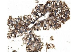 IHC analysis of Aconitase 1/ACO1 using anti-Aconitase 1/ACO1 antibody (ABIN7598988). (Aconitase 1 antibody  (AA 1-137))