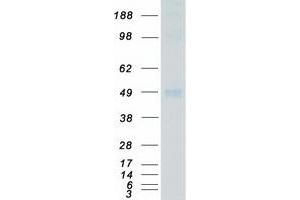Validation with Western Blot (JNK2 Protein (Myc-DYKDDDDK Tag))