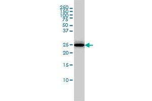 RGS2 monoclonal antibody (M01), clone 4C4 Western Blot analysis of RGS2 expression in MCF-7 . (RGS2 antibody  (AA 111-211))