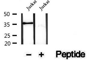 Western blot analysis of extracts of Jurkat cells, using Phospho-CDK6(Tyr13) Antibody.