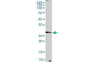 PTPLB MaxPab rabbit polyclonal antibody. (PTPLB antibody  (AA 1-254))