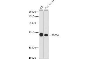 Western blot analysis of extracts of various cell lines, using RA antibody (ABIN7269798) at 1:1000 dilution. (RAB1A antibody  (AA 1-205))