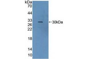 Detection of Recombinant vWA2, Human using Polyclonal Antibody to Von Willebrand Factor A Domain Containing Protein 2 (vWA2) (VWA2 antibody  (AA 457-708))